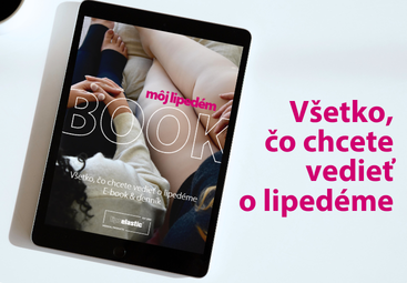 E-book o lipedéme zadarmo: príznaky, strava a cvičenie